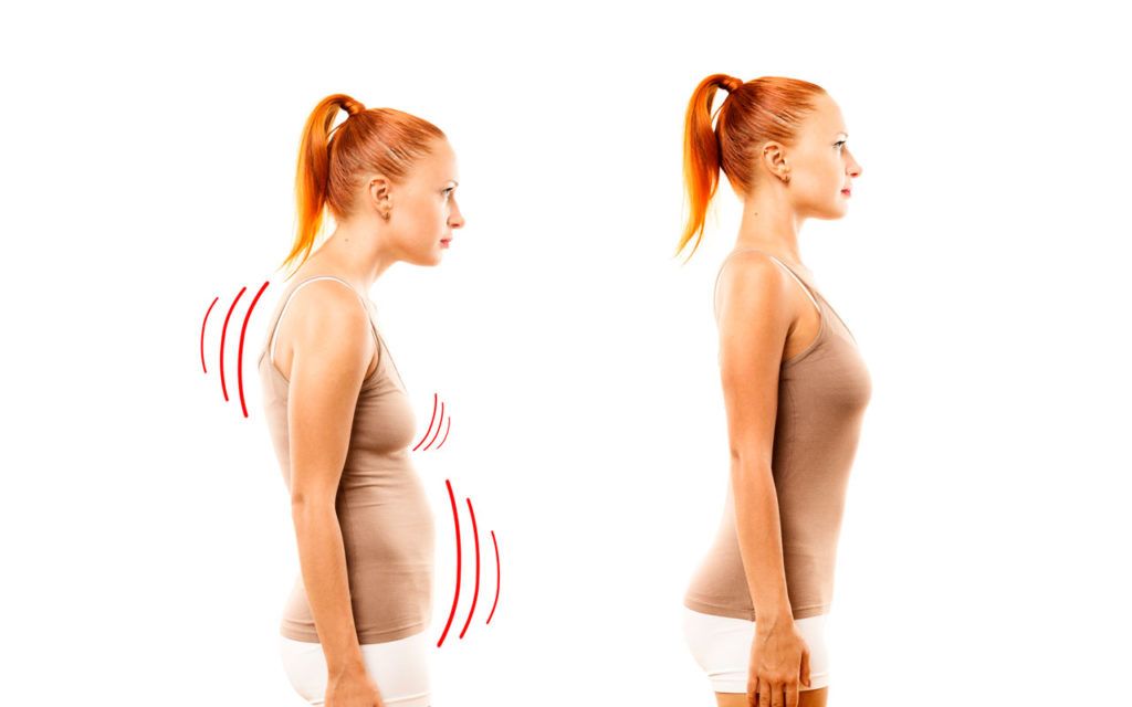 Alteración postural, una reacción, una adaptación