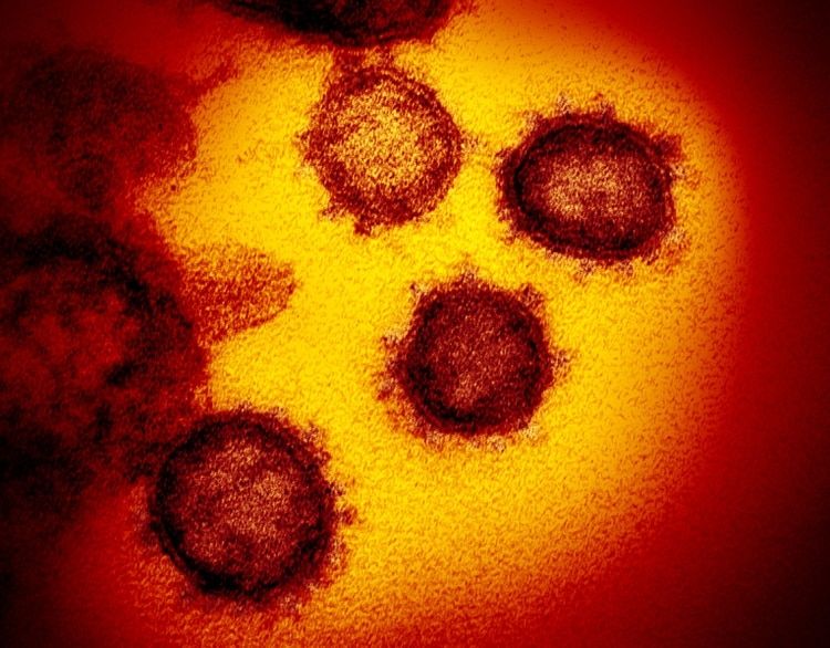 Qué cantidad de coronavirus es suficiente para infectar a una persona