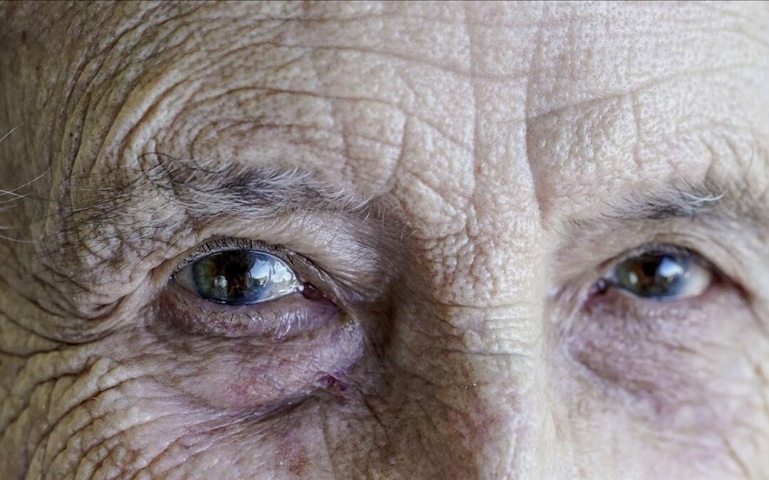 Statement of the signatory gerontological entities: Old age is not a disease!
