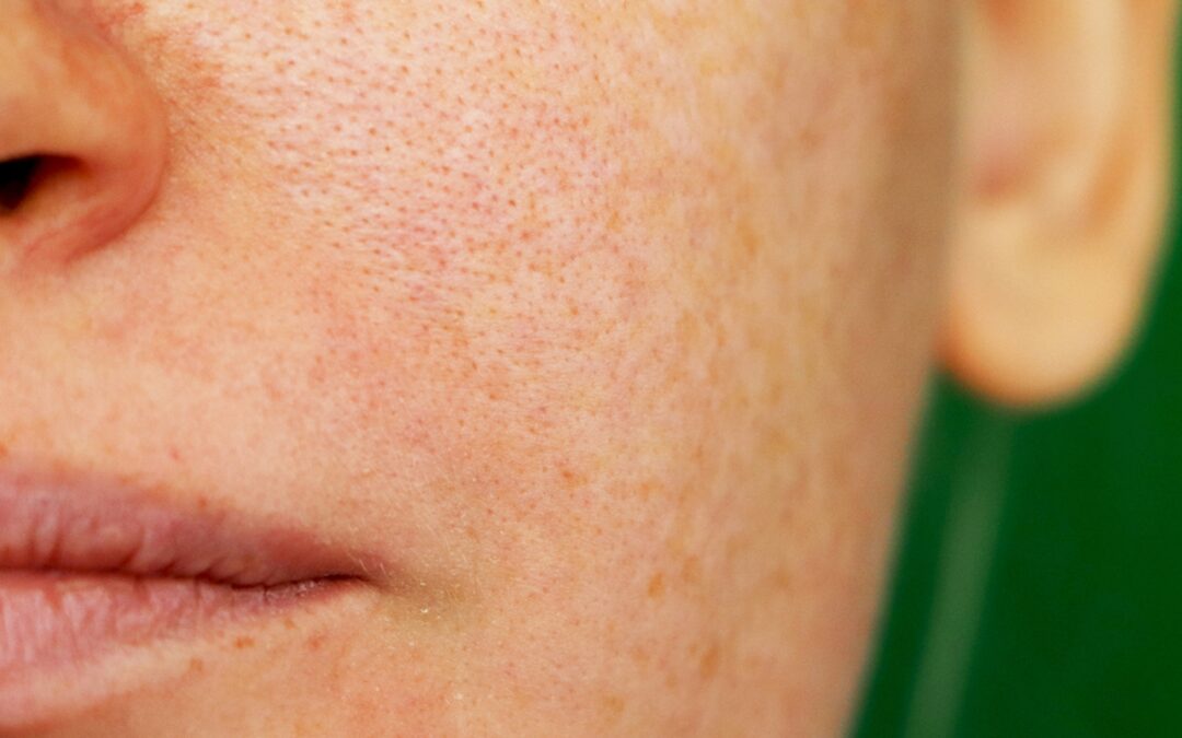 La aplicación de Google de asistencia dermatológica virtual con inteligencia artificial