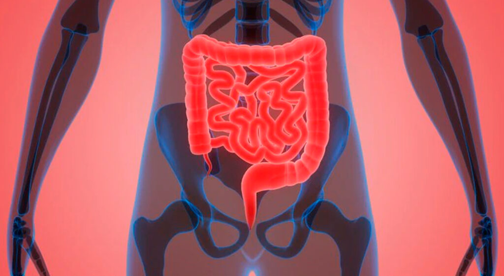 Problemas intestinales-Sistema inmune