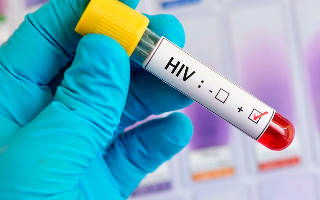 Comienzan a probar en humanos una vacuna contra el VIH