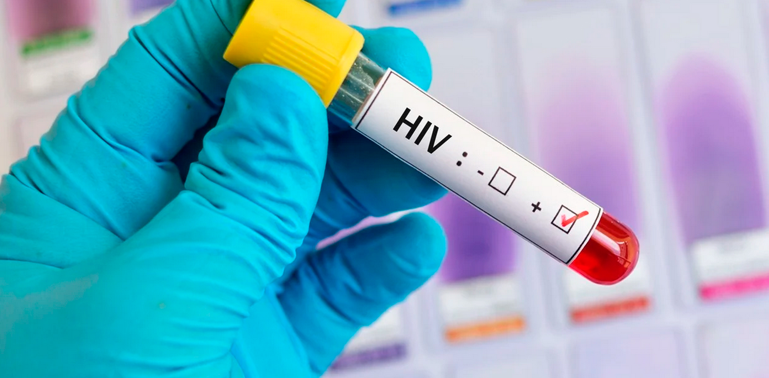 Comienzan a probar en humanos una vacuna contra el VIH - Caja de la ...