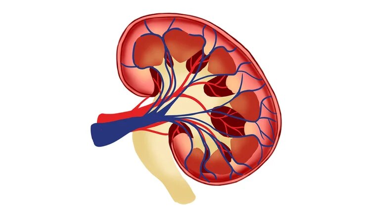 Enfermedad renal