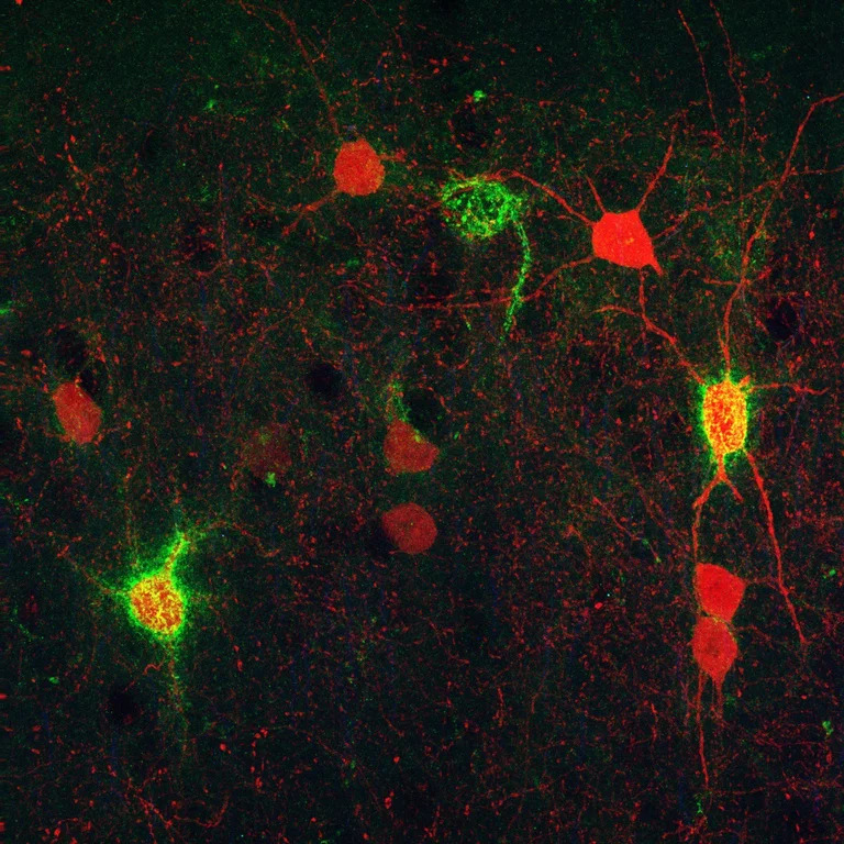 funcionamiento neuronas esquizofrenia