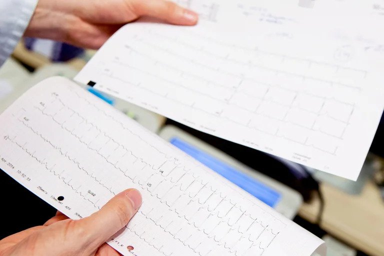síntomas-cardiología