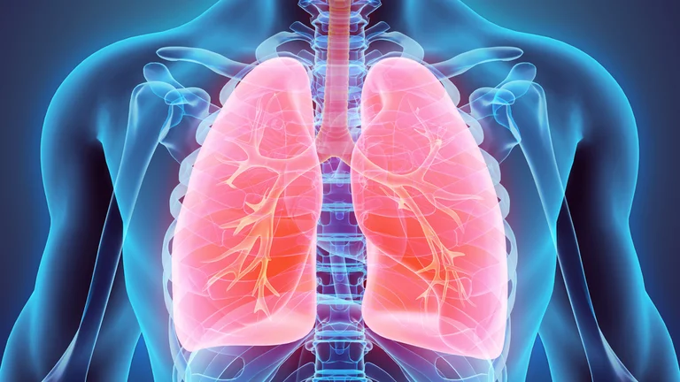 Fibrosis quística - pulmones
