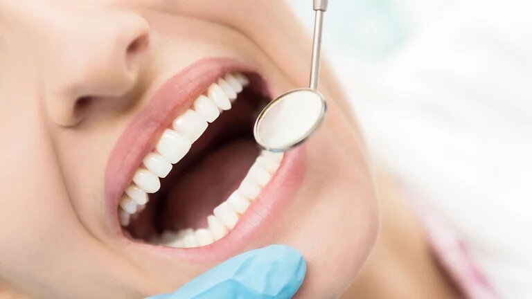 Qué bebidas y alimentos dañan la dentadura y cómo actuar para evitarlo