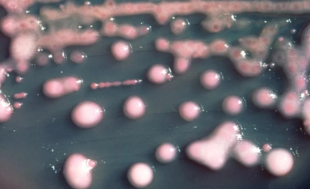 bacteria Klebsiella