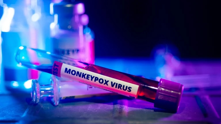 Viruela del mono-virus