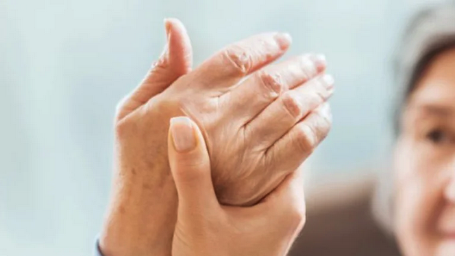 Artritis Reumatoide: qué tipo de enfermedad es, a quiénes afecta y cómo se trata