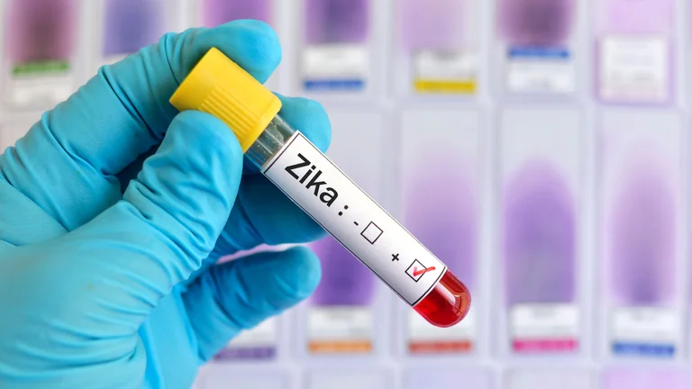 Virus Zika