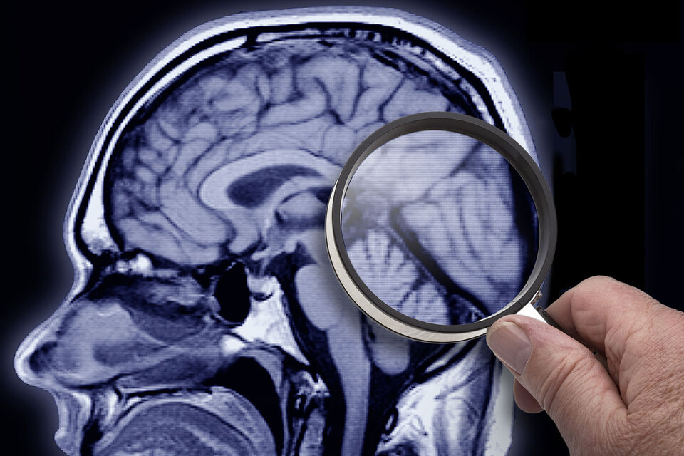 Alzheimer: un hallazgo podría permitir la detección temprana