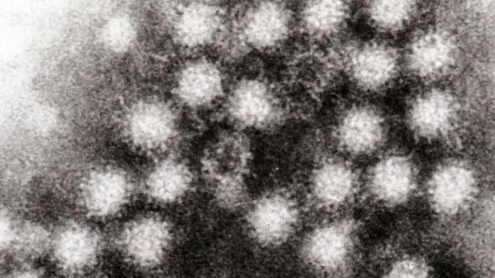 Infección por norovirus
