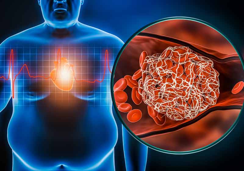 Gestión del riesgo cardiometabólico