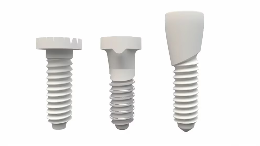 Salud oral-Implante cerámico es fabricado con zirconia de alta calidad