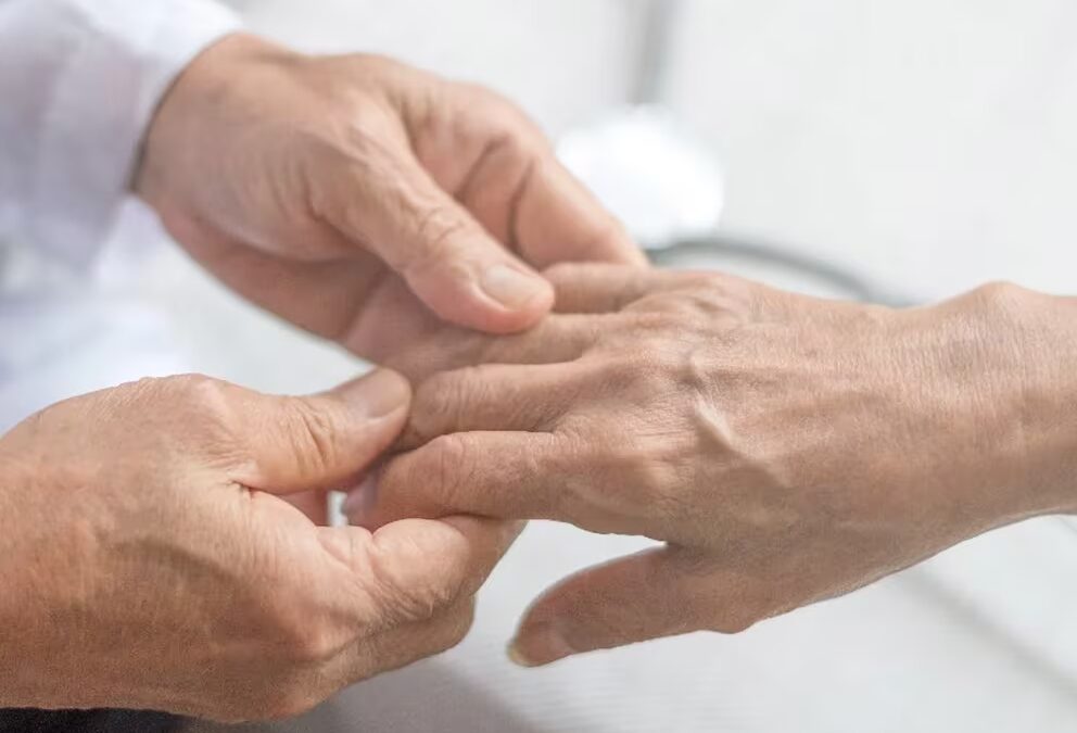 La biopsia de piel podría ayudar a diagnosticar el Parkinson y otros trastornos cerebrales