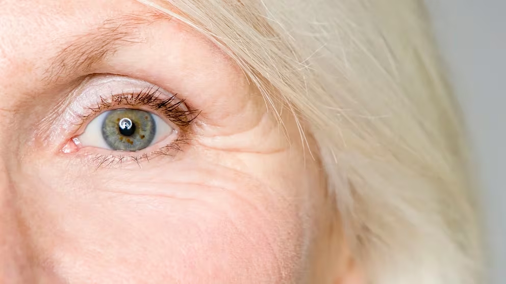 Cuáles son las novedades en el tratamiento de la principal causa de ceguera en mayores de 50 años