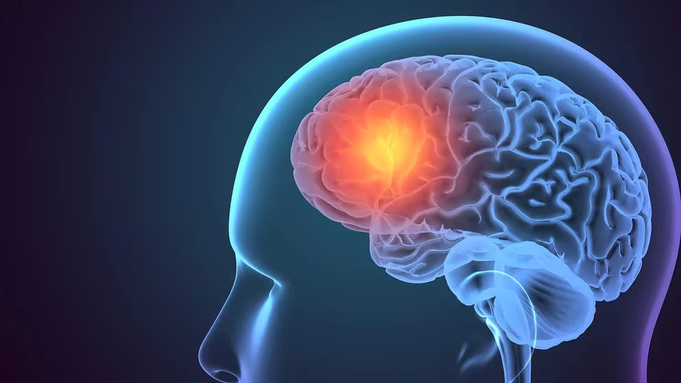Epilepsia: cuáles son los mitos y verdades sobre la enfermedad neurológica más frecuente en los niños