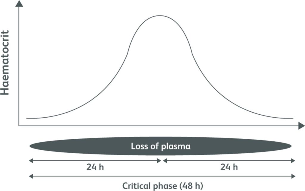 Representación esquemática de la fuga de plasma durante la fase crítica del dengue hemorrágico.