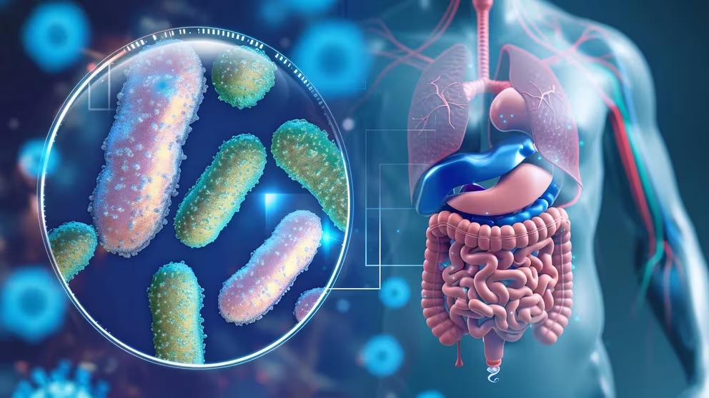 Microbiota intestinal se puede producir por diversas causas