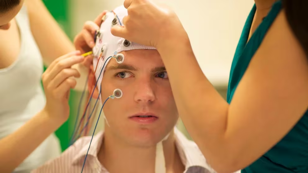 Pacientes con epilepsia tienen implantes que monitorean la actividad cerebral